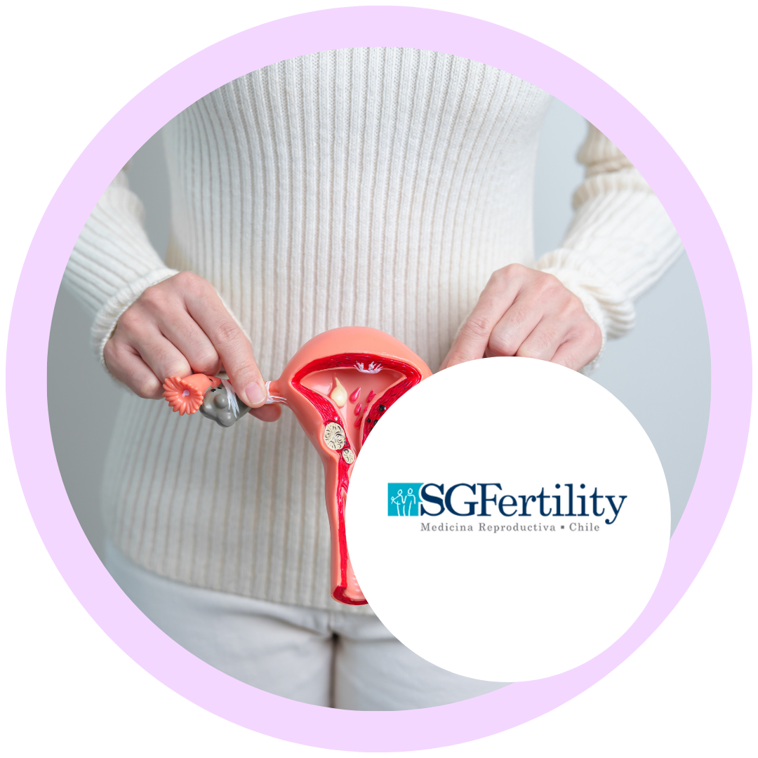 Descuento en un tratamiento de inseminación intrauterina (IIU) en SG Fertility